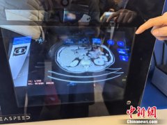 中新健康丨空中调阅患者资料，科幻！手术室也迎来“黑科技”